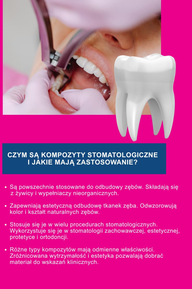 Czym są kompozyty stomatologiczne i jakie mają zastosowanie?